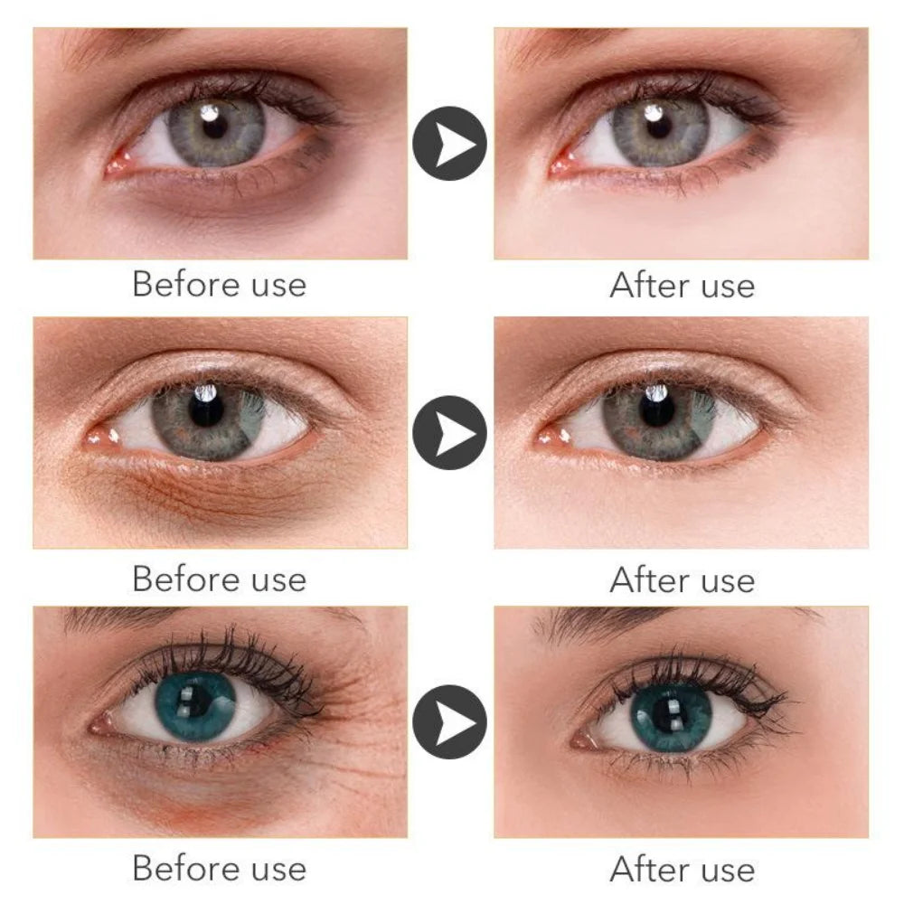 Retinol Anti-Aging Whitening Oil Control Eye Serum Gold Serum Korean Skin Care Products